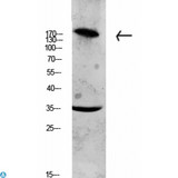 COL11A1 / Collagen XI Alpha 1 Antibody - Western blot analysis of CACO2 lysate, antibody was diluted at 1000. Secondary antibody was diluted at 1:20000.