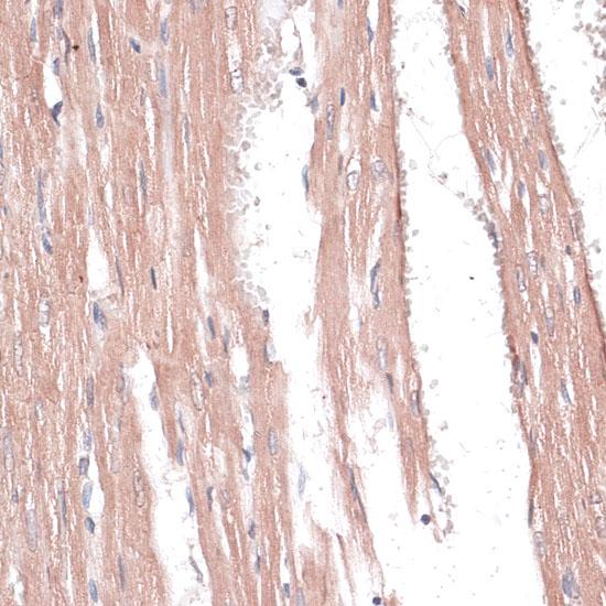 COL11A1 / Collagen XI Alpha 1 Antibody - Immunohistochemistry of paraffin-embedded Rat heart using COL11A1 Polyclonal Antibody at dilution of 1:100 (40x lens).