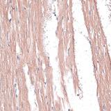 COL11A1 / Collagen XI Alpha 1 Antibody - Immunohistochemistry of paraffin-embedded Rat heart using COL11A1 Polyclonal Antibody at dilution of 1:100 (40x lens).