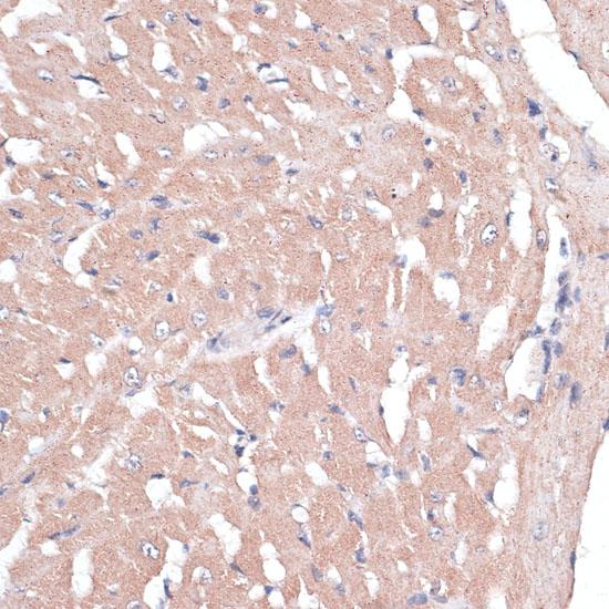 COL11A1 / Collagen XI Alpha 1 Antibody - Immunohistochemistry of paraffin-embedded Mouse heart using COL11A1 Polyclonal Antibody at dilution of 1:100 (40x lens).