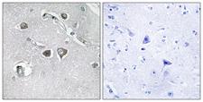 COL11A2 / Collagen XI Antibody - Immunohistochemistry analysis of paraffin-embedded human brain tissue, using Collagen XI alpha2 Antibody. The picture on the right is blocked with the synthesized peptide.