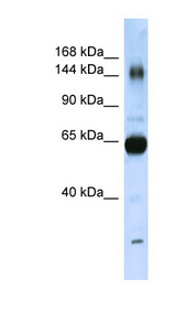 COL11A2 / Collagen XI Antibody - COL11A2 antibody Western blot of Placenta lysate. This image was taken for the unconjugated form of this product. Other forms have not been tested.