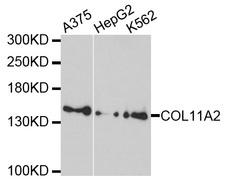 COL11A2 / Collagen XI Antibody - Western blot analysis of extracts of various cell lines, using COL11A2 antibody at 1:1000 dilution. The secondary antibody used was an HRP Goat Anti-Rabbit IgG (H+L) at 1:10000 dilution. Lysates were loaded 25ug per lane and 3% nonfat dry milk in TBST was used for blocking. An ECL Kit was used for detection and the exposure time was 90s.