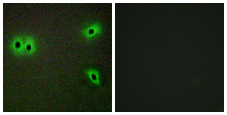 COL13A1 / Collagen XIII Antibody - Immunofluorescence analysis of A549 cells, using Collagen XIII alpha1 Antibody. The picture on the right is blocked with the synthesized peptide.