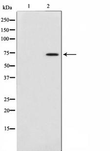 COL13A1 / Collagen XIII Antibody - Western blot analysis on 3T3 cell lysates using Collagen XIIIalpha 1 antibody. The lane on the left is treated with the antigen-specific peptide.