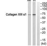 COL13A1 / Collagen XIII Antibody - Western blot analysis of extracts from 3T3/K562 cells, using Collagen XIII a1 antibody.