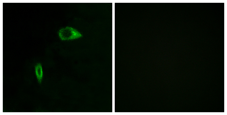 COL14A1 / Collagen XIV Antibody - Immunofluorescence analysis of HeLa cells, using Collagen XIV alpha1 Antibody. The picture on the right is blocked with the synthesized peptide.
