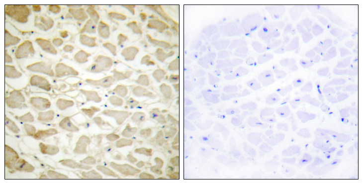 COL14A1 / Collagen XIV Antibody - Immunohistochemistry analysis of paraffin-embedded human heart tissue, using Collagen XIV alpha1 Antibody. The picture on the right is blocked with the synthesized peptide.