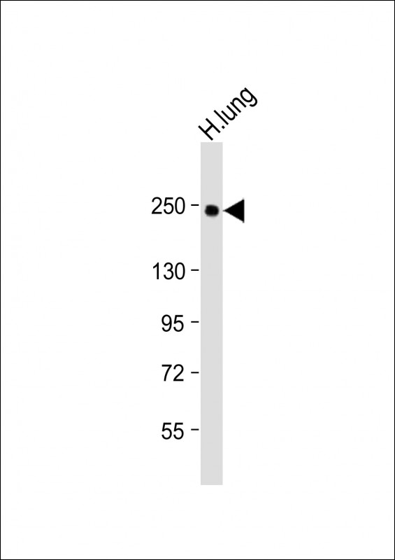 COL14A1 / Collagen XIV Antibody - Anti-COL14A1 Antibody (Center) at 1:2000 dilution + Human lung lysate Lysates/proteins at 20 µg per lane. Secondary Goat Anti-Rabbit IgG, (H+L), Peroxidase conjugated at 1/10000 dilution. Predicted band size: 194 kDa Blocking/Dilution buffer: 5% NFDM/TBST.
