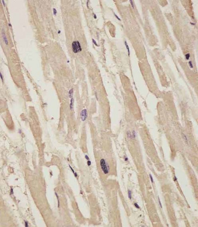 COL14A1 / Collagen XIV Antibody - COL14A1 Antibody (Center) staining COL14A1 in human heart tissue sections by Immunohistochemistry (IHC-P - paraformaldehyde-fixed, paraffin-embedded sections). Tissue was fixed with formaldehyde and blocked with 3% BSA for 0. 5 hour at room temperature; antigen retrieval was by heat mediation with a citrate buffer (pH6). Samples were incubated with primary antibody (1/25) for 1 hours at 37°C. A undiluted biotinylated goat polyvalent antibody was used as the secondary antibody.