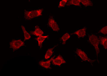 COL14A1 / Collagen XIV Antibody - Staining HepG2 cells by IF/ICC. The samples were fixed with PFA and permeabilized in 0.1% Triton X-100, then blocked in 10% serum for 45 min at 25°C. The primary antibody was diluted at 1:200 and incubated with the sample for 1 hour at 37°C. An Alexa Fluor 594 conjugated goat anti-rabbit IgG (H+L) Ab, diluted at 1/600, was used as the secondary antibody.