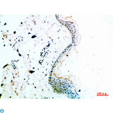 COL14A1 / Collagen XIV Antibody - Immunohistochemical analysis of paraffin-embedded human-skin, antibody was diluted at 1:200.