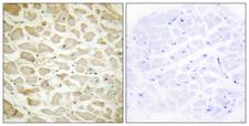 COL14A1 / Collagen XIV Antibody - Peptide - + Immunohistochemistry analysis of paraffin-embedded human heart tissue using Collagen XIV a1 antibody.