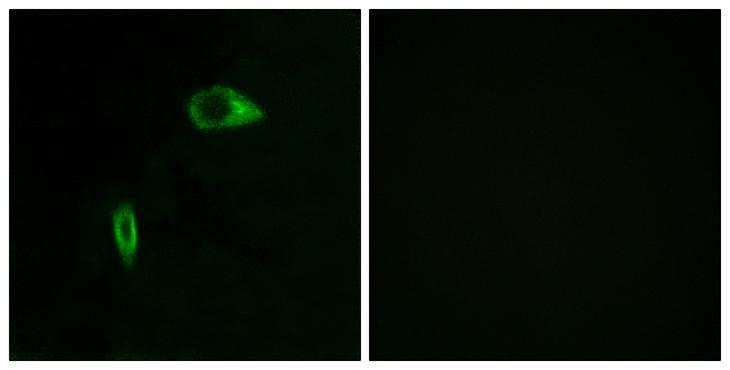 COL14A1 / Collagen XIV Antibody - Peptide - + Immunofluorescence analysis of HeLa cells, using Collagen XIV a1 antibody.