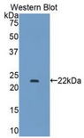COL15A1 / Collagen XV Alpha 1 Antibody - Western blot of recombinant COL15A1 / Collagen XV.
