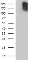 COL15A1 / Collagen XV Alpha 1 Antibody - HEK293T cells were transfected with the pCMV6-ENTRY control (Left lane) or pCMV6-ENTRY COL15A1 (Right lane) cDNA for 48 hrs and lysed. Equivalent amounts of cell lysates (5 ug per lane) were separated by SDS-PAGE and immunoblotted with anti-COL15A1.