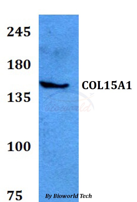COL15A1 / Collagen XV Alpha 1 Antibody - Western blot of COL15A1 antibody at 1:500 dilution. Lane 1: HEK293T whole cell lysate.