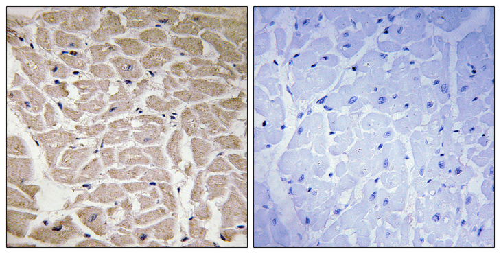 COL16A1 Antibody - Immunohistochemistry analysis of paraffin-embedded human heart tissue, using Collagen XVI alpha1 Antibody. The picture on the right is blocked with the synthesized peptide.