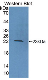 COL16A1 Antibody - Western blot of COL16A1 antibody.