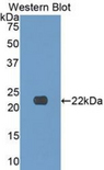 COL17A1 / Collagen XVII Antibody - Western blot of recombinant COL17A1 / Collagen XVII.  This image was taken for the unconjugated form of this product. Other forms have not been tested.
