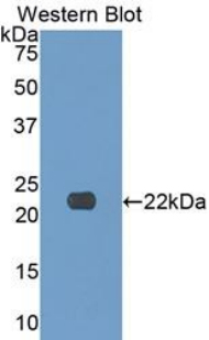 COL17A1 / Collagen XVII Antibody - Western blot of recombinant COL17A1 / Collagen XVII.  This image was taken for the unconjugated form of this product. Other forms have not been tested.