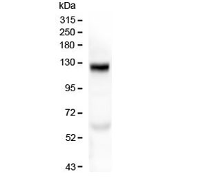 COL17A1 / Collagen XVII Antibody - Western blot testing of human placenta with COL17A1 antibody at 0.5ug/ml. Expected molecular weight ~120 kDa and ~180 kDa.