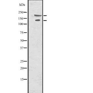 COL17A1 / Collagen XVII Antibody - Western blot analysis of Collagen XVII using HepG2 whole cells lysates