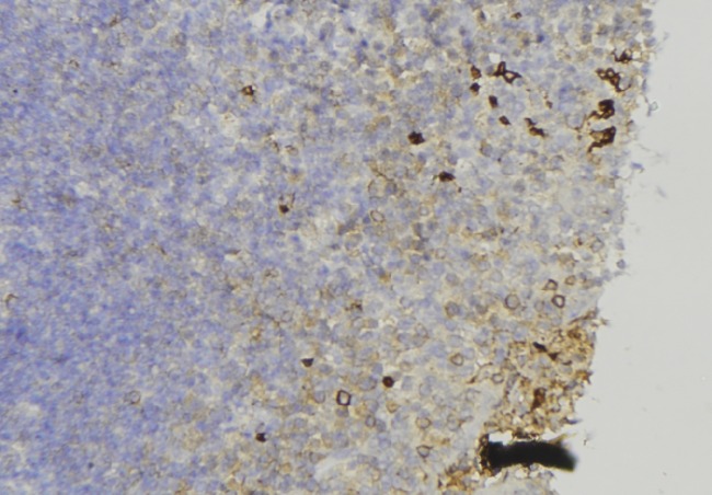COL17A1 / Collagen XVII Antibody - 1:100 staining human lymph node tissue by IHC-P. The sample was formaldehyde fixed and a heat mediated antigen retrieval step in citrate buffer was performed. The sample was then blocked and incubated with the antibody for 1.5 hours at 22°C. An HRP conjugated goat anti-rabbit antibody was used as the secondary.