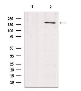 COL17A1 / Collagen XVII Antibody - Western blot analysis of extracts of mouse brain tissue using Collagen XVII antibody. Lane 1 was treated with the blocking peptide.
