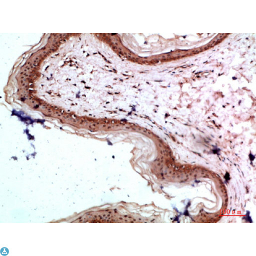 COL17A1 / Collagen XVII Antibody - Immunohistochemical analysis of paraffin-embedded human-colon, antibody was diluted at 1:200.