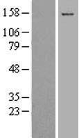COL17A1 / Collagen XVII Protein - Western validation with an anti-DDK antibody * L: Control HEK293 lysate R: Over-expression lysate
