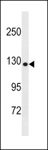 COL19A1 / Collagen XIX Antibody - COL19A1 Antibody western blot of Uterus tissue lysates (35 ug/lane). The COL19A1 antibody detected the COL19A1 protein (arrow).