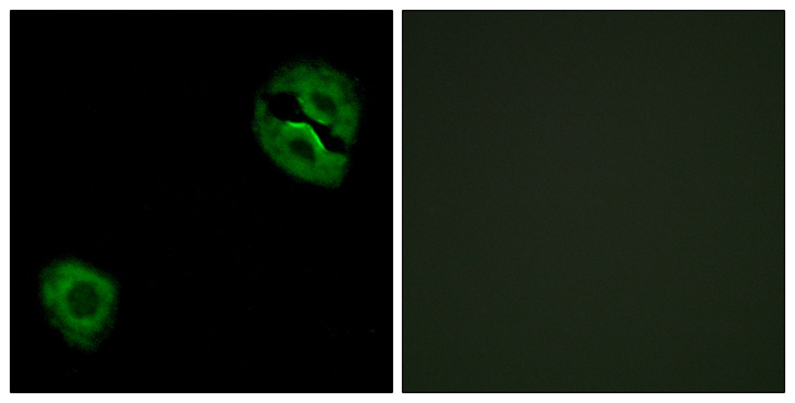 COL19A1 / Collagen XIX Antibody - Immunofluorescence analysis of A549 cells, using Collagen XIX alpha1 Antibody. The picture on the right is blocked with the synthesized peptide.