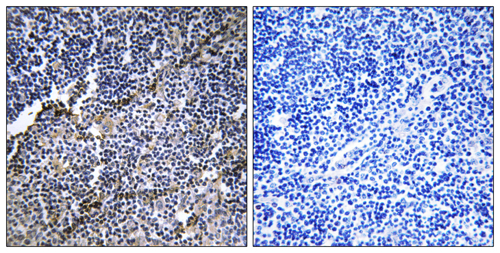 COL19A1 / Collagen XIX Antibody - Immunohistochemistry analysis of paraffin-embedded human thymus gland tissue, using Collagen XIX alpha1 Antibody. The picture on the right is blocked with the synthesized peptide.