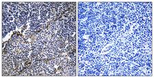 COL19A1 / Collagen XIX Antibody - Immunohistochemistry analysis of paraffin-embedded human thymus gland tissue, using Collagen XIX alpha1 Antibody. The picture on the right is blocked with the synthesized peptide.