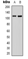 COL19A1 / Collagen XIX Antibody - Western blot analysis of Collagen 19 alpha 1 expression in HeLa (A); HepG2 (B) whole cell lysates.
