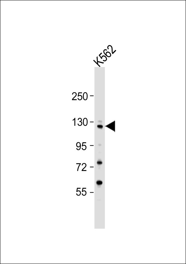 COL19A1 / Collagen XIX Antibody - Anti-Collagen 19 alpha 1 Antibody at 1:1000 dilution + K562 whole cell lysate Lysates/proteins at 20 ug per lane. Secondary Goat Anti-Rabbit IgG, (H+L), Peroxidase conjugated at 1:10000 dilution. Predicted band size: 115 kDa. Blocking/Dilution buffer: 5% NFDM/TBST.