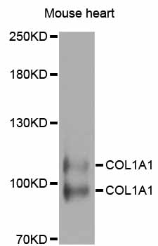 COL1A1 / Collagen I Alpha 1 Antibody - Western blot analysis of extracts of mouse heart, using COL1A1 antibody at 1:1000 dilution. The secondary antibody used was an HRP Goat Anti-Rabbit IgG (H+L) at 1:10000 dilution. Lysates were loaded 25ug per lane and 3% nonfat dry milk in TBST was used for blocking. An ECL Kit was used for detection and the exposure time was 20s.