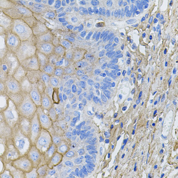 COL1A1 / Collagen I Alpha 1 Antibody - Immunohistochemistry of paraffin-embedded human esophagus using COL1A1 antibodyat dilution of 1:100 (40x lens).