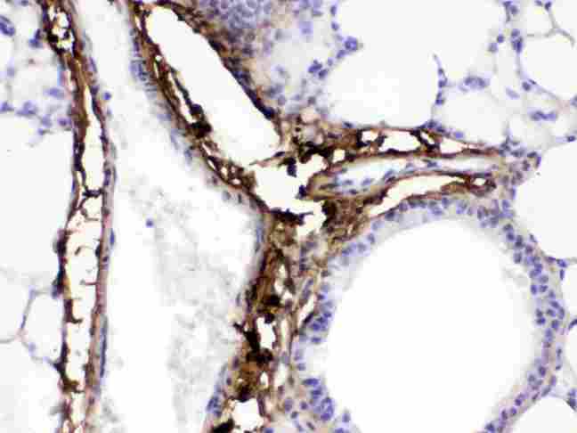 COL1A1 / Collagen I Alpha 1 Antibody - Collagen I was detected in paraffin-embedded sections of mouse lung tissues using rabbit anti- Collagen I Antigen Affinity purified polyclonal antibody