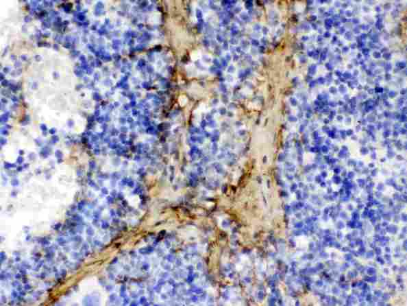 COL1A1 / Collagen I Alpha 1 Antibody - Collagen I was detected in paraffin-embedded sections of rat spleen tissues using rabbit anti- Collagen I Antigen Affinity purified polyclonal antibody
