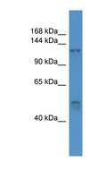 COL1A1 / Collagen I Alpha 1 Antibody - COL1A1 antibody Western blot of Fetal Muscle lysate.  This image was taken for the unconjugated form of this product. Other forms have not been tested.