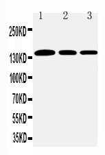 COL1A1 / Collagen I Alpha 1 Antibody - Collagen I antibody Western blot. Lane 1: Rat Lung Tissue Lysate. Lane 2: Human Placenta Tissue Lysate. Lane 3: Rat Testis Tissue Lysate.