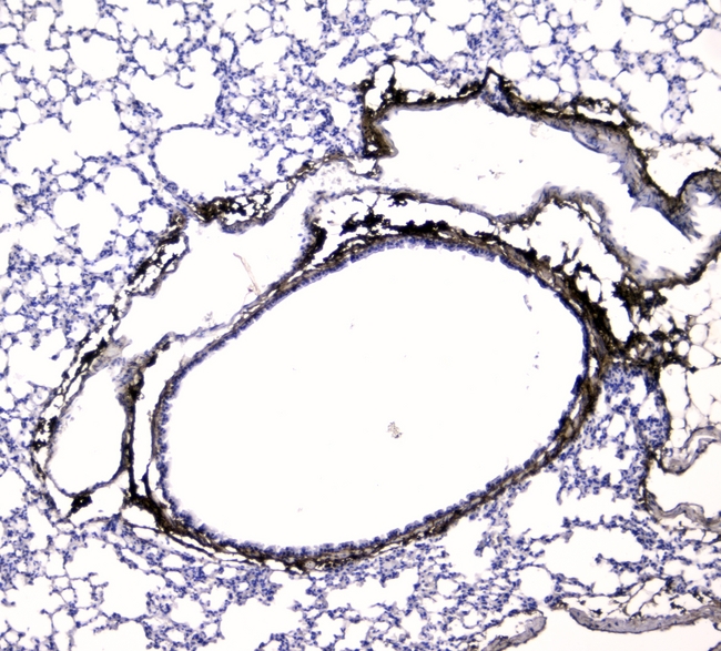 COL1A1 / Collagen I Alpha 1 Antibody - IHC analysis of Collagen I/COL1A1 using anti-Collagen I/COL1A1 antibody. Collagen I/COL1A1 was detected in paraffin-embedded section of mouse lung tissues. Heat mediated antigen retrieval was performed in citrate buffer (pH6, epitope retrieval solution) for 20 mins. The tissue section was blocked with 10% goat serum. The tissue section was then incubated with 2µg/ml rabbit anti-Collagen I/COL1A1 Antibody overnight at 4°C. Biotinylated goat anti-rabbit IgG was used as secondary antibody and incubated for 30 minutes at 37°C. The tissue section was developed using Strepavidin-Biotin-Complex (SABC) with DAB as the chromogen.