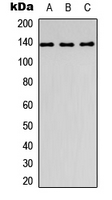 COL1A1 / Collagen I Alpha 1 Antibody - Western blot analysis of Collagen 1 alpha 1 expression in HEK293T (A); Raw264.7 (B); PC12 (C) whole cell lysates.