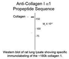 COL1A1 / Collagen I Alpha 1 Antibody