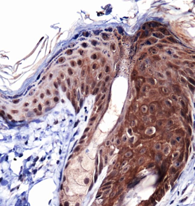COL1A1 / Collagen I Alpha 1 Antibody - Immunohistochemistry: Collagen I Antibody - Analysis of Collagen 1 in mouse epidermis using DAB with hematoxylin counterstain.  This image was taken for the unconjugated form of this product. Other forms have not been tested.