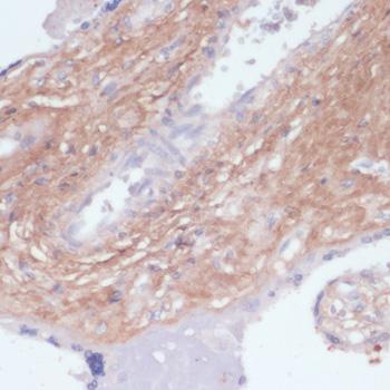 COL1A1 / Collagen I Alpha 1 Antibody - Immunohistochemistry of paraffin-embedded Human placenta using COL1A1 Polyclonal Antibody at dilution of 1:200 (40x lens).