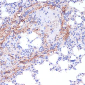 COL1A1 / Collagen I Alpha 1 Antibody - Immunohistochemistry of paraffin-embedded Mouse lung using COL1A1 Polyclonal Antibody at dilution of 1:200 (40x lens).