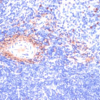 COL1A1 / Collagen I Alpha 1 Antibody - Immunohistochemistry of paraffin-embedded Mouse spleen using COL1A1 Polyclonal Antibody at dilution of 1:200 (40x lens).